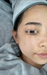 -SKIN79皮肤管理中心