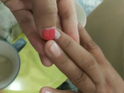 -初樱科技美学问题肌修复中心