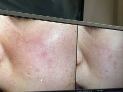-苑苑vbeauty科技美容SPA