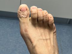 -Andrew指甲专科灰指甲·甲沟炎矫正·3D步态矫形鞋垫定制(上海法华镇路旗舰店)