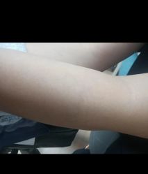 -天道专业洗纹身