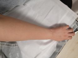 -薇兰专业脱毛连锁机构