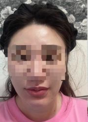 体验前-澳尔颜选医疗美容