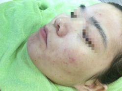 -苗医生草本科技祛痘