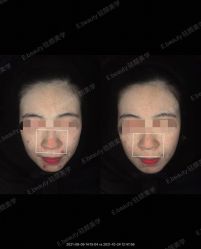 -E.beauty驻颜·痘敏肌调理中心
