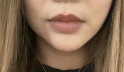 -海涛医疗美容·面部抗衰·注射美鼻