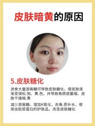 -克丽缇娜