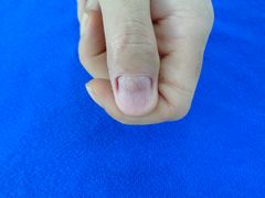 -世龙世家甲沟炎·灰指甲·嵌甲矫正·修脚(武侯区双楠店)