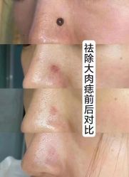 -木北造型