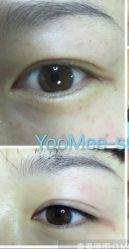 -YooMee优美智能科技美肤机构