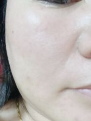 -痣清宫祛斑祛痣连锁店