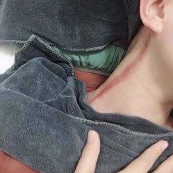 -安那般那皮肤年轻化ANAPANA