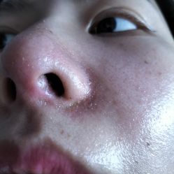 体验后-厦门美莱整形美容医院