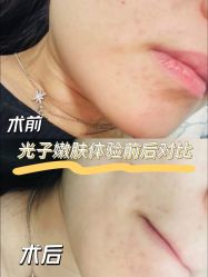 -天津伊美尔医疗整形美容专科医院