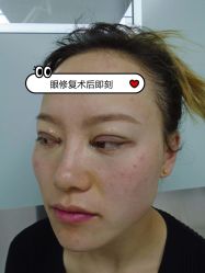 -素美医疗美容·西南眼鼻整形·修复基地