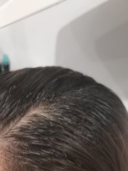 -熙朵美学植发·连锁品牌