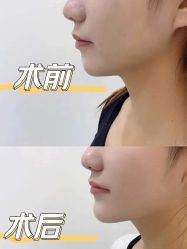 -广州粤秀医疗美容医院