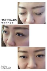 睫毛嫁接-光SPA科技美肤