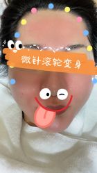 体验后-上海首尔丽格医疗美容医院