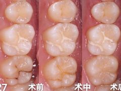-固瑞齿科·口腔·种植·矫正(恒隆分院)