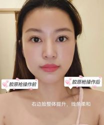 -LUNA皮相美·骨相美高级美感