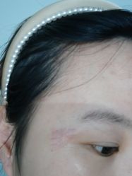 -正璞医疗美容·皮肤修复·微整注射