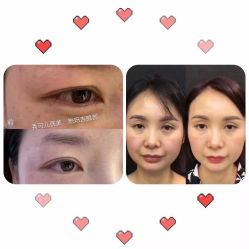 -贝黎诗SPA