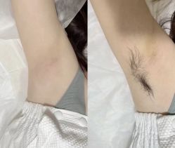 -植蔻妍倍儿专业脱毛·皮肤管理