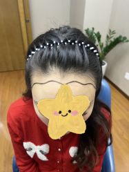 点击看大图 体验前-大麦微针植发全国连锁