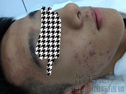 -蕾特恩专业祛痘·皮肤管理