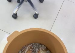 -派恩宜灰指甲鸡眼嵌甲手足癣