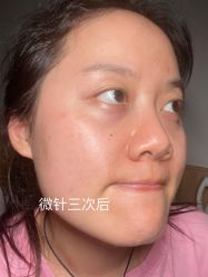 -Yestar艺星医疗美容医院
