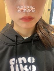 体验前-Yestar艺星医疗美容医院