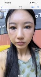 体验后-南京康美美容医院·旗舰店