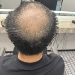-唐风采假发补发定制