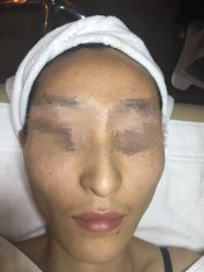 -皇族养心堂·净痘·修敏·御颜