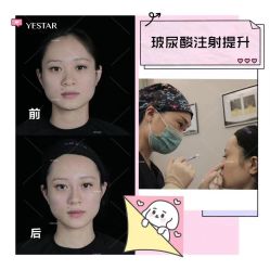 -Yestar艺星医疗美容医院