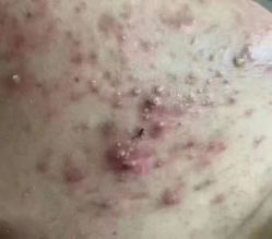 -+MS卓美丝专业祛痘·皮肤管理中心
