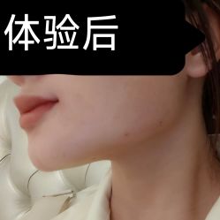 体验后-南宁华美医疗美容医院