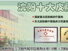 沈阳哪里治疗鱼鳞病好-辽宁省人民医院
