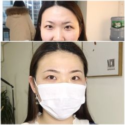 -Doris多里斯半永久纹眉·SMP纹发·发际线