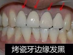 -团圆口腔·种植中心(锦江院区)