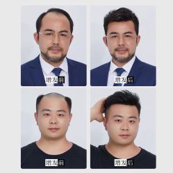 -发饰美男士增发补发假发定制店