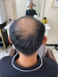 -唐风采假发补发定制