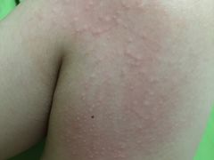 -北京东直门智选假日酒店