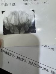 -首都医科大学附属北京儿童医院