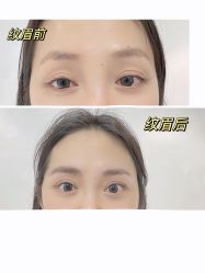 -MISS STAR·半永久纹眉·发际线·美瞳线