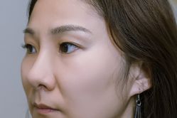 -Doris多里斯半永久纹眉·SMP纹发·发际线