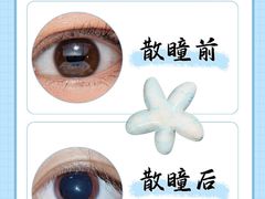 -黑马眼科·近视手术