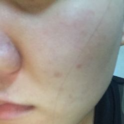 点击看大图 -MedSkinCare科技祛痘肌肤修护中心
